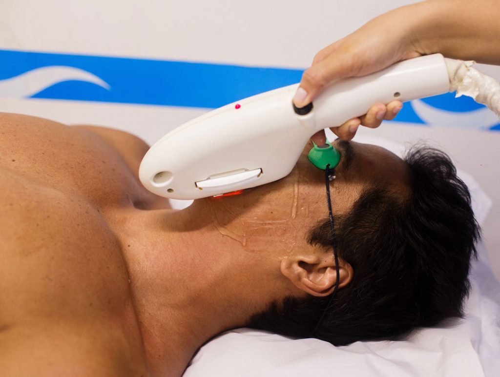 Depilação a laser Fotodepilação preço