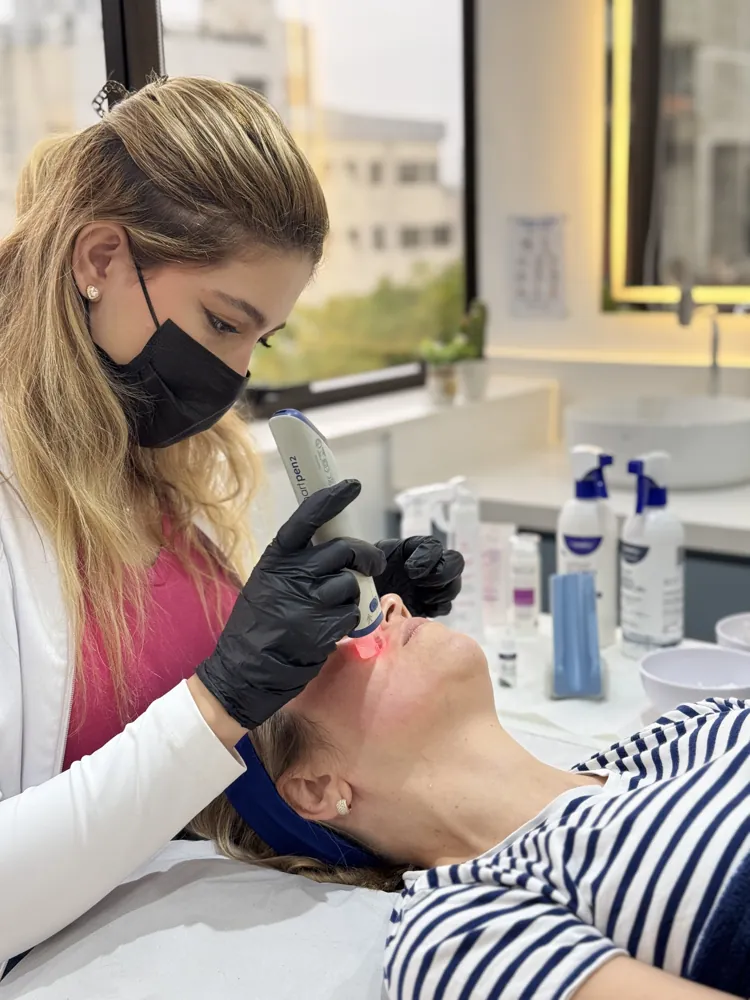 Microagulhamento com caneta elétrica e ponteira estéril descartável na Bonapele